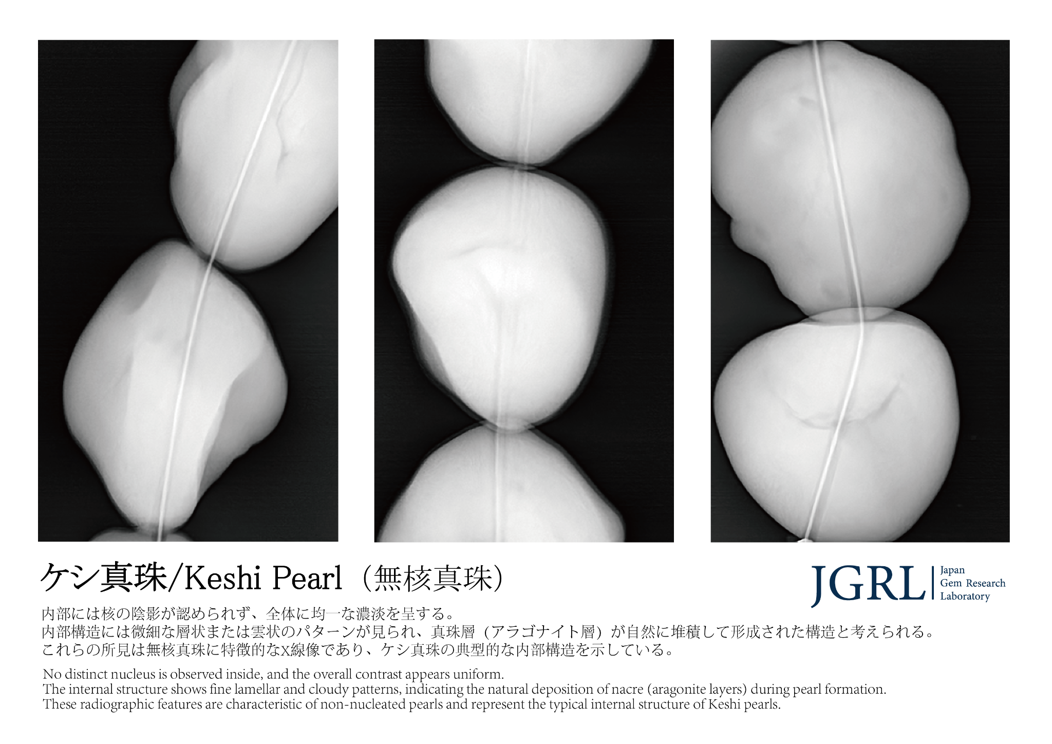 ケシ真珠のX線検査例。3つの画像に、核の陰影が見られない内部構造を示す。